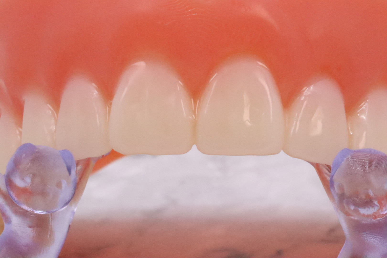 Sprintray Apex Teeth